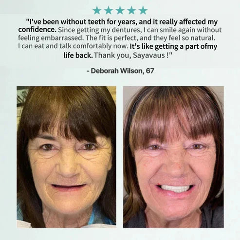đEnds Today: 70% OFF! â°SAYAVAUSâąCustom-Fit Instant Smile Dentures â Natural Looking Comfort Fit