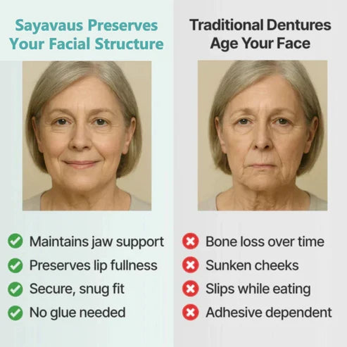 🌎Ends Today: 70% OFF! ⏰SAYAVAUS™Custom-Fit Instant Smile Dentures – Natural Looking Comfort Fit