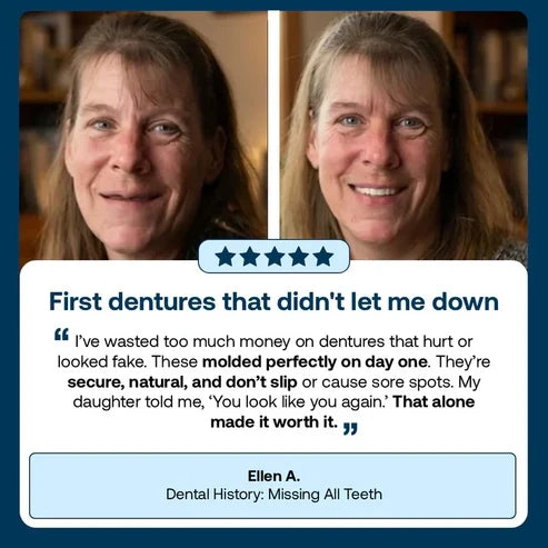 🌎Ends Today: 70% OFF! ⏰SAYAVAUS™Custom-Fit Instant Smile Dentures – Natural Looking Comfort Fit