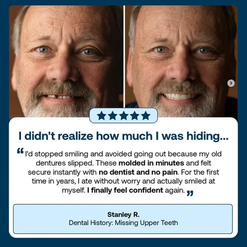 🌎Ends Today: 70% OFF! ⏰SAYAVAUS™Custom-Fit Instant Smile Dentures – Natural Looking Comfort Fit