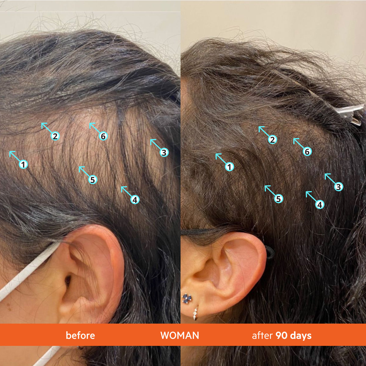 Revita Kit | High-Performance Hair Density Shampoo & Conditioner