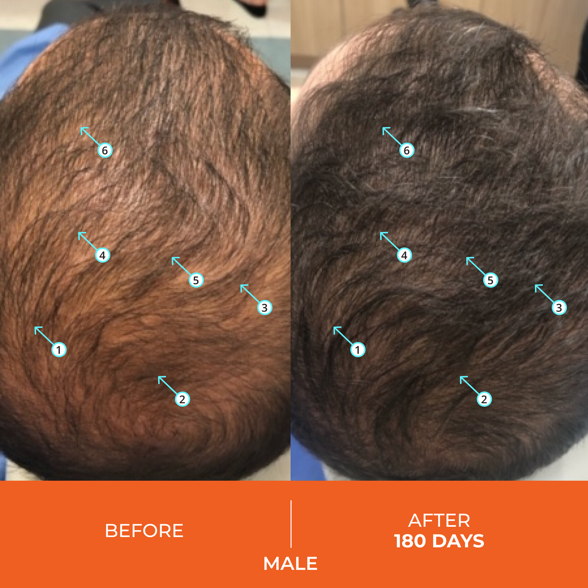 Revita Kit | High-Performance Hair Density Shampoo & Conditioner