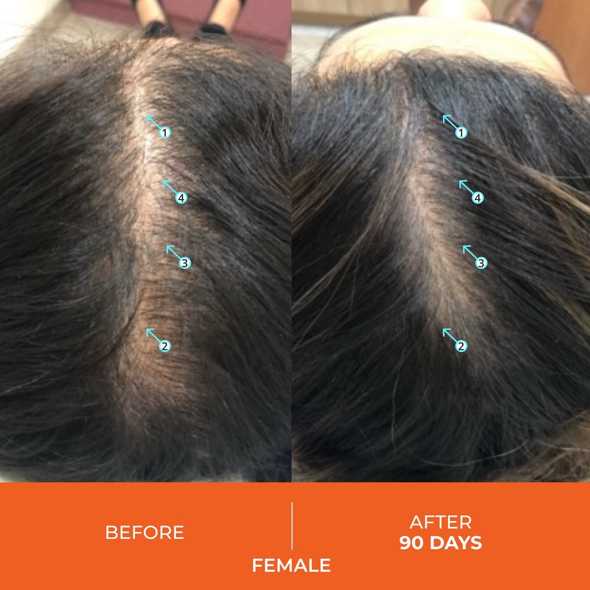 Revita Kit | High-Performance Hair Density Shampoo & Conditioner